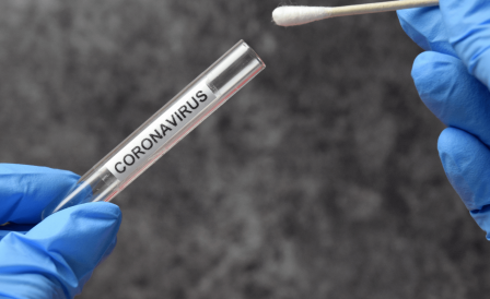 COVID 19 – Teste agora será obrigatório para boa parte do mundo